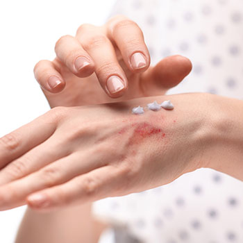 一般皮膚科とは