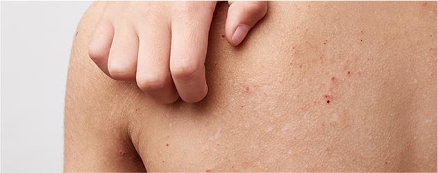 アレルギー疾患に力を入れております。