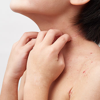 小児皮膚科とは